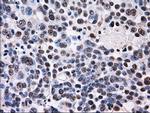 ID3 Antibody in Immunohistochemistry (Paraffin) (IHC (P))