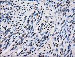 ID3 Antibody in Immunohistochemistry (Paraffin) (IHC (P))