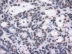 ID3 Antibody in Immunohistochemistry (Paraffin) (IHC (P))