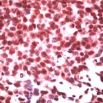 ID3 Antibody in Immunohistochemistry (IHC)