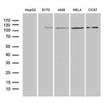 IDE Antibody in Western Blot (WB)