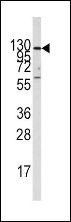 IDE Antibody in Western Blot (WB)