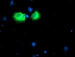 IDS Antibody in Immunocytochemistry (ICC/IF)