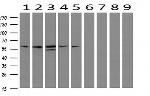 IDS Antibody in Western Blot (WB)