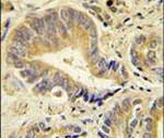 IDUA Antibody in Immunohistochemistry (IHC)