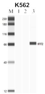 IFIT2 Antibody in Immunoprecipitation (IP)