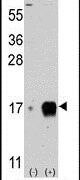 IFITM3 Antibody in Western Blot (WB)