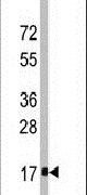 IFITM3 Antibody in Western Blot (WB)