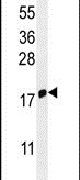IFITM5 Antibody in Western Blot (WB)