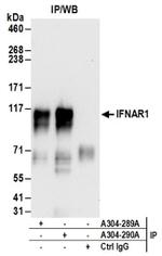 IFNAR1 Antibody in Immunoprecipitation (IP)
