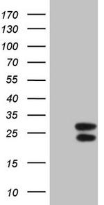 IFNG Antibody in Western Blot (WB)