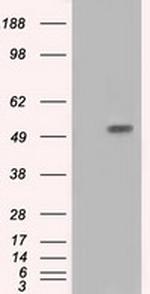 IFT57 Antibody in Western Blot (WB)