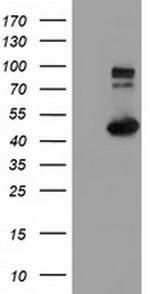 IFT57 Antibody in Western Blot (WB)