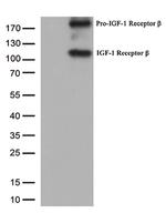 IGF1R Antibody in Western Blot (WB)