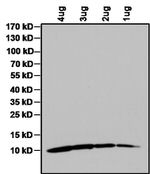 IGF1 Monoclonal Antibody (1C5-1A2)