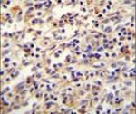 IGF2BP2 Antibody in Immunohistochemistry (IHC)