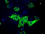IGF2BP2 Antibody in Immunocytochemistry (ICC/IF)