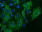 IGF2BP2 Antibody in Immunocytochemistry (ICC/IF)