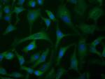 IGF2BP2 Antibody in Immunocytochemistry (ICC/IF)