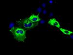 IGF2BP2 Antibody in Immunocytochemistry (ICC/IF)