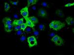 IGF2BP2 Antibody in Immunocytochemistry (ICC/IF)