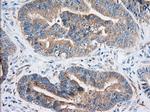 IGF2BP2 Antibody in Immunohistochemistry (Paraffin) (IHC (P))