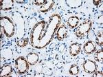 IGF2BP2 Antibody in Immunohistochemistry (Paraffin) (IHC (P))