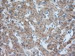 IGF2BP2 Antibody in Immunohistochemistry (Paraffin) (IHC (P))