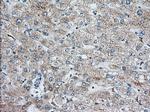 IGF2BP2 Antibody in Immunohistochemistry (Paraffin) (IHC (P))