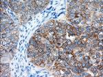 IGF2BP2 Antibody in Immunohistochemistry (Paraffin) (IHC (P))