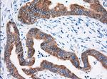 IGF2BP2 Antibody in Immunohistochemistry (Paraffin) (IHC (P))