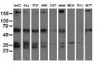 IGF2BP2 Antibody in Western Blot (WB)