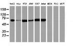 IGF2BP2 Antibody in Western Blot (WB)
