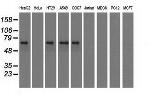 IGF2BP2 Antibody in Western Blot (WB)
