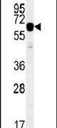 IGF2BP2 Antibody in Western Blot (WB)
