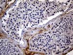 IGF2BP3 Antibody in Immunohistochemistry (Paraffin) (IHC (P))