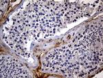 IGF2BP3 Antibody in Immunohistochemistry (Paraffin) (IHC (P))