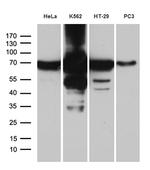 IGF2BP3 Antibody in Western Blot (WB)