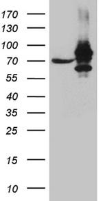 IGF2BP3 Antibody in Western Blot (WB)
