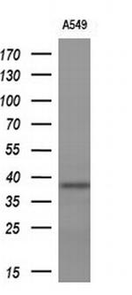 IGFBP2 Antibody in Western Blot (WB)