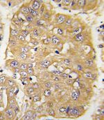 IGFBP3 Antibody in Immunohistochemistry (IHC)