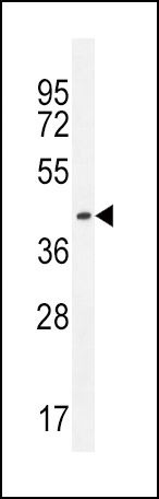 IGHG1 Antibody in Western Blot (WB)