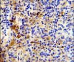 J Chain Antibody in Immunohistochemistry (IHC)