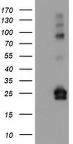 IGJ Antibody in Western Blot (WB)