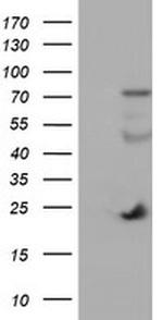 IGJ Antibody in Western Blot (WB)