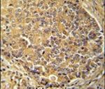 IGSF1 Antibody in Immunohistochemistry (IHC)