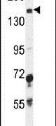 IGSF1 Antibody in Western Blot (WB)