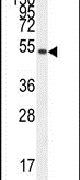 IGSF5 Antibody in Western Blot (WB)