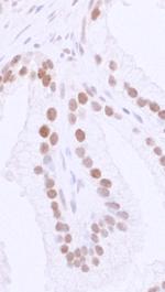 53BP1 Antibody in Immunohistochemistry (Paraffin) (IHC (P))