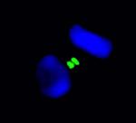 Aurora B Antibody in Immunocytochemistry (ICC/IF)